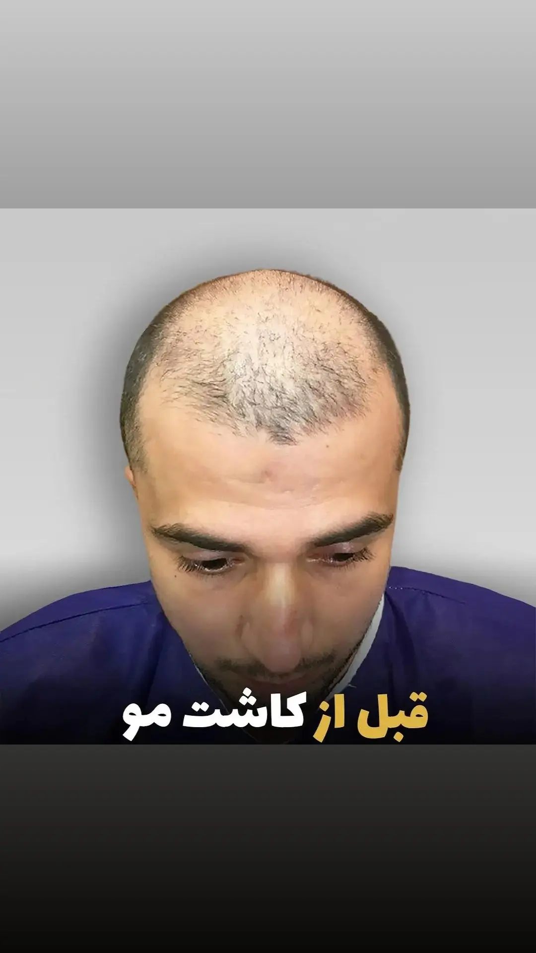 زیبایی